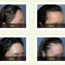 연세헤어성형외과의원 이미지