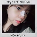 서초사랑약국 | 코수술 준비물 리스트 BEST 7 안 사면 무조건 후회하는 붓기·회복 필수템 Feat. 삶의 질 상승