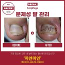 안양네일 자연미인네일&amp;내성발톱&amp;발톱무좀 안양범계점 디자인문의