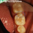 서울아산이치과의원 이미지