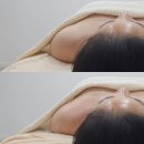 GS25경산미래점 | 경북 경산 에스테틱 물오른피부 웨딩관리 찐 후기