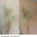 은평성심약국 | 핫딜에 추가할인까지 받아가는 세벨리아💜