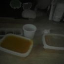 신사동-1 | [스마일라식 1년 후기] 신사동 안과 내돈내산 &amp; 아벨리노 검사/통증 현실 (라섹 비교)