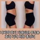 나비약국 | 나비약 후기 디에타민 부작용 효과 가격 처방 총정리