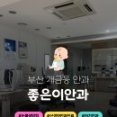 좋은이안과의원 네이버블로그