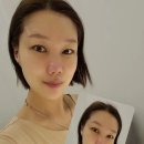레스테틱광교 이미지