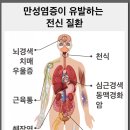 &#39;통증&#39;은 &#39;염증&#39;이다! &#39;만성염증&#39; 잡아야 관절통, 근육통 잡힌다 [닥터웰빙톡] 이미지