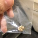 중앙수치과의원 | 의정부 중앙수치과 후기