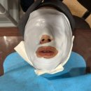 이건한의원 - 수원시 팔달구 정조로 697 | 로담한의원 새살침 후기 오래된 여드름흉터 6회차 리뷰