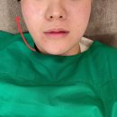 한결의원 | 압구정 에테르나 의원 온다리프팅 찐 후기