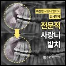 서울바른경치과의원 | 사랑니 발치, 서울바른경치과에서 알아봅시다.