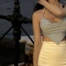 하얀멍이 | #5 솔직한 팔뚝 지방추출주사 미친후기 3달차 변화 총정리