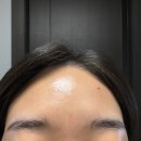 가메조네 | 대구 신부관리 MS에스테틱 칠곡에스테틱 메조핏 온천 스파 관리 전신 림프 순환관리 피부관리 후기