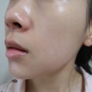 레이저 이미지