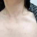 아토패션 | 아토피보습제 찾는다면 낫포유 아토리스 이치 멀티밤 아토밤 추천