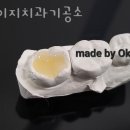 신세계치과기공소 이미지
