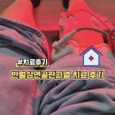 반월상연골판파열 치료 후기