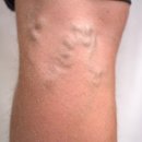 아나파적맥통증의원 이미지