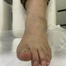 바미네일레푸스용인 | 충주내성발톱 관리 잘하는 곳, 바미네일 레푸스 충주연수점 후기 (충주발관리)
