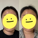 케이뷰티프로페셔널 | 내돈내산 약손명가 사당점 맞춤관리 후기 -4회차&5회차 이중턱 관리,윤곽 조각 얼굴 관리