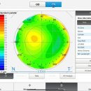 안경백서 이미지