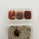 에스정네일 | 40대 시험관 시술과정, 시험관 1차 성공 후기, 저자극 용법, 난자 채취, 신선 이식 후기
