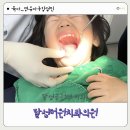 달성더원치과의원 네이버블로그