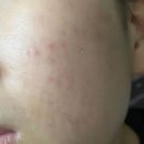 미미약국 이미지