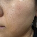 한국리페어기술 | 전문 관리 시술 후 예민해진 피부를 위한 장벽 케어 | 지피덤 EGF 맥스 베리어 리페어 크림 사용 후기