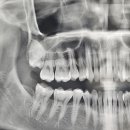 이튼튼구강악안면외과치과의원 이미지