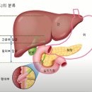 중증 간경변 환자에게 복수가 차는 이유 이미지