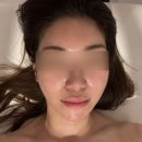에스뷰티라운지 | 대전 윤곽관리 끌리메 대전관저점 끌링작은얼굴관리 받고 얼굴형 찾은 솔직 후기
