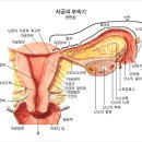 여성 질병의 종류 이미지