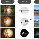 아이캐슬안경원 이미지