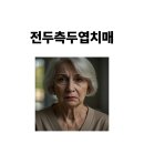 전두측두엽치매 특징 증상 원인 치료 다양한 정보