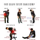 좌골신경통(Sciatica)의 원인과 증상, 적절한 치료법 이미지