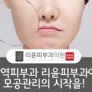 리윤피부과의원 네이버블로그