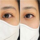 채운코아루@ | 울산 속눈썹 연장 | 뷰티인사이드 - LED속눈썹으로 자연스러운 눈매 완성