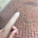 광개토병원 | 대구 화상병원 푸른병원 후기와 광개토병원과의 비교, 실비 청구