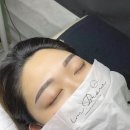 임브로우