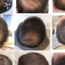 불정로376번길 이미지