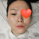 신사역 피부관리 : 은브로우 앤 뷰티 스킨플래닝 솔직후기 (웨딩스킨플래닝)