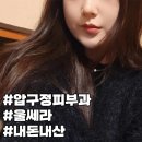 예뻐지는마법 | 압구정피부과 울쎄라, 몰래 예뻐지는 방법 ! 내돈내산 후기