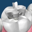 리빙웰치과병원 이미지