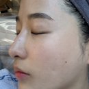 로이 힐링 | 담양 피부관리 <로이뷰티> esv10 모공디톡스 후기| 담양피부관리• 바디케어