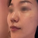 더(The)피부빛나