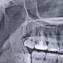 박경준치과의원 | 3대 사랑니 공장 추천 (사랑이아프니 / 잎사귀 / 박경준 장단점 비교)