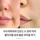 이수역 4번 출구 앞 | 이수역피부과 인모드 fx 포마 차이 팔자주름 효과 통증 부작용 후기