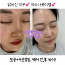 뷰티인아나 | 🧴청주 봉명동 피부관리 추천 “피아나뷰티랩” 수분절임케어 후기