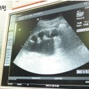 우성한의원 이미지